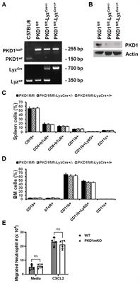 Protein kinase D1 in myeloid lineage cells contributes to the accumulation of CXCR3+CCR6+ nonconventional Th1 cells in the lungs and potentiates hypersensitivity pneumonitis caused by S. rectivirgula